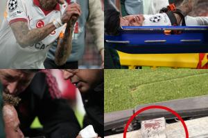 手指幸运保。。。。。。A：诺阿·朗的大拇指不必截肢，，，但伤势严重_24直播网