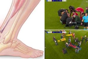 天下杯危！康复专家：；；；；；；倏丝赡苁歉於狭眩，，，，将缺席9-12个月_24直播网